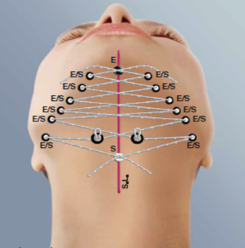 Happy Lift thread treatment 